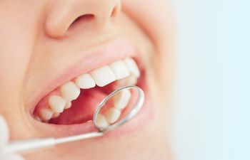 Young woman undergoing dental checkup.