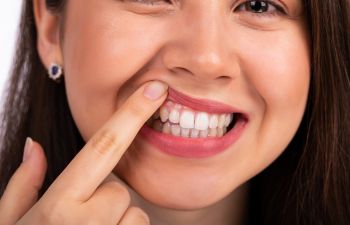 Woman showing upper jaw gum.